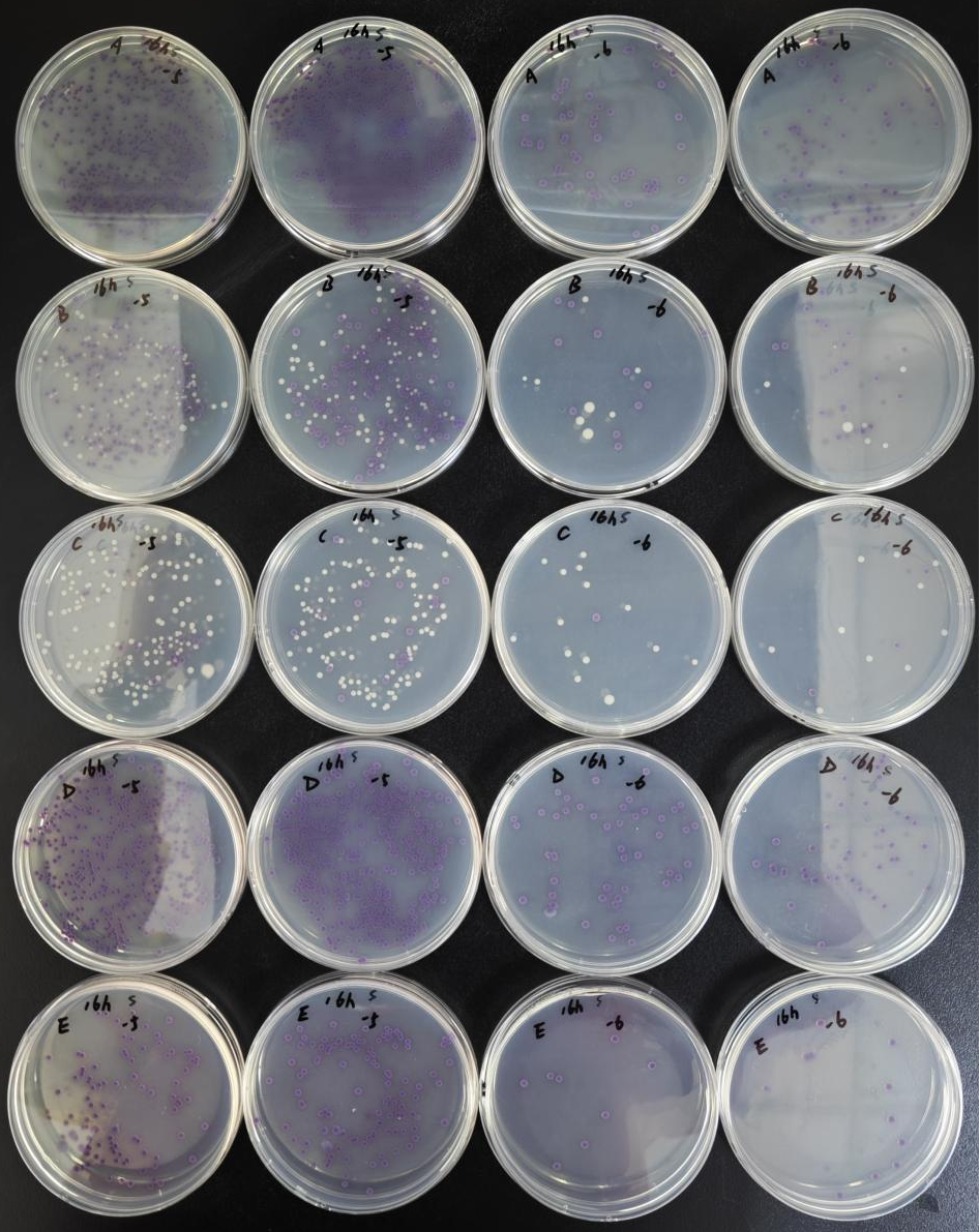 不同廠家RVS肉湯增菌效果的比較 不同廠家RVS肉湯增菌效果的比較